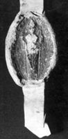 A061000