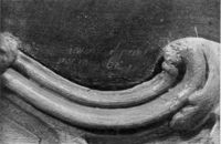 A113736