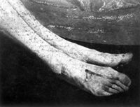 B014218