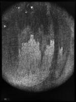 B055181