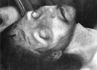 B135776