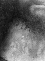 B171672
