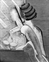 B237513