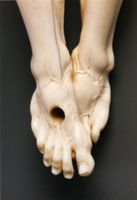 KM002990
