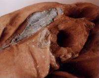 KN000101