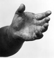N006000