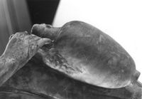 T036316