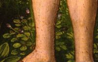 di076240